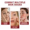 OUHOE Collagen Membrane, Lighten Wrinkles, Bags, Dark Circles, Firm Skin, Plump And Moisturize Eye Mask