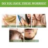 OUHOE Hair Care Rosemary Oil, Anti-Loss Hair Nourish And Strengthen Hair Care Essential Oil