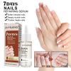 Jaysuing 7 Day Nail Care Essence Grey Nail, Hand, Foot And Nail Nourishing Cleansing Essence
