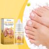 South Moon Bee Venom Nail Care Essence Foot Gray Nails Brightening Nails Rotten Nails Soft Nails Nail Care