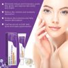 Azelaic Acid Infused Face Moisturizer With Nicotinamide Mild Gentle Skin Care Cream Smooth Uneven Skin Texture Daily Facial Balancing Cream