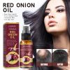 OUHOE Onion Essential Oil, Strengthens And Hydrates Hair Dense Hair Care Spray